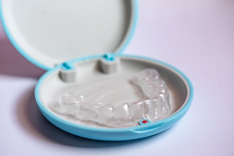 an invisalign clear retainer helping align your teeth and make them straight