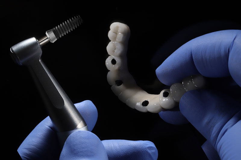 a full arch of teeth with holes for dental implants and a doctor holding up tools to place it
