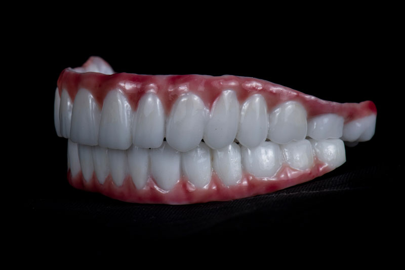 a full arch of teeth top to bottom with zirconia and a pearly white smile