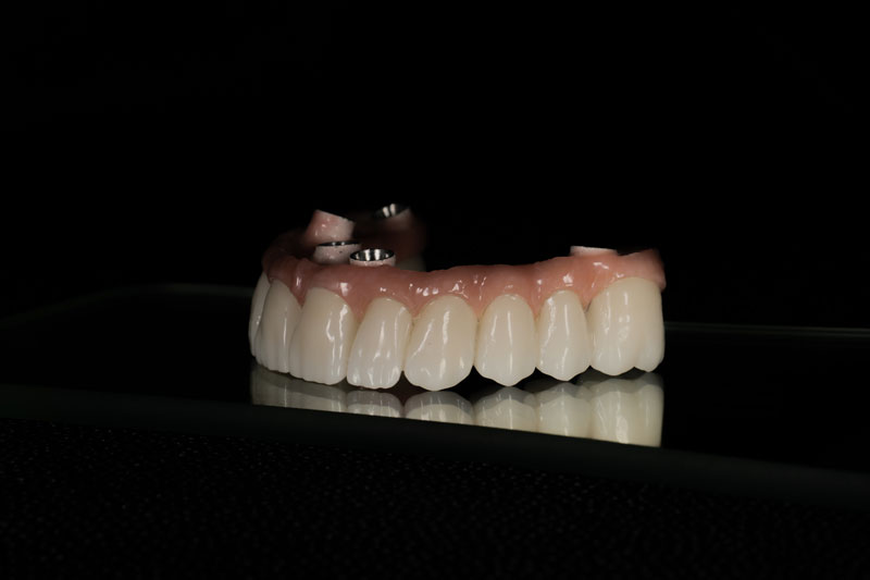 a full arch of zirconia teeth that have 4 holes in it to place it