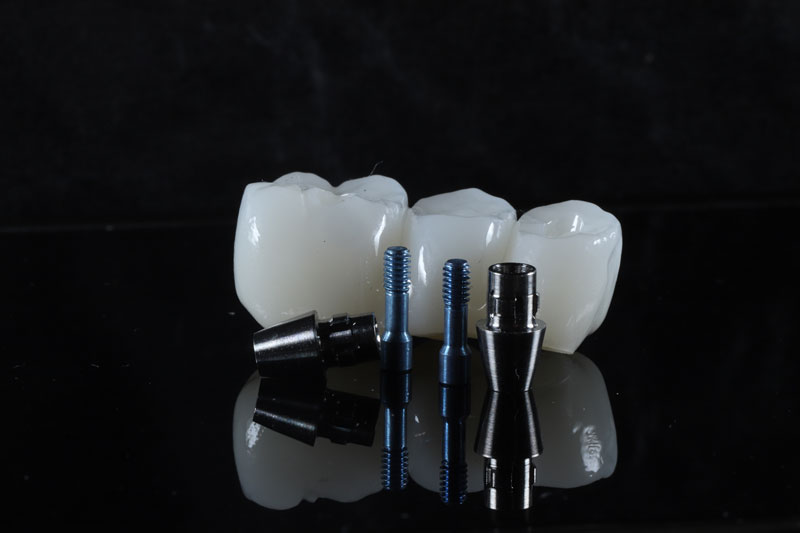 a dental implant bridge with holes for them to be placed