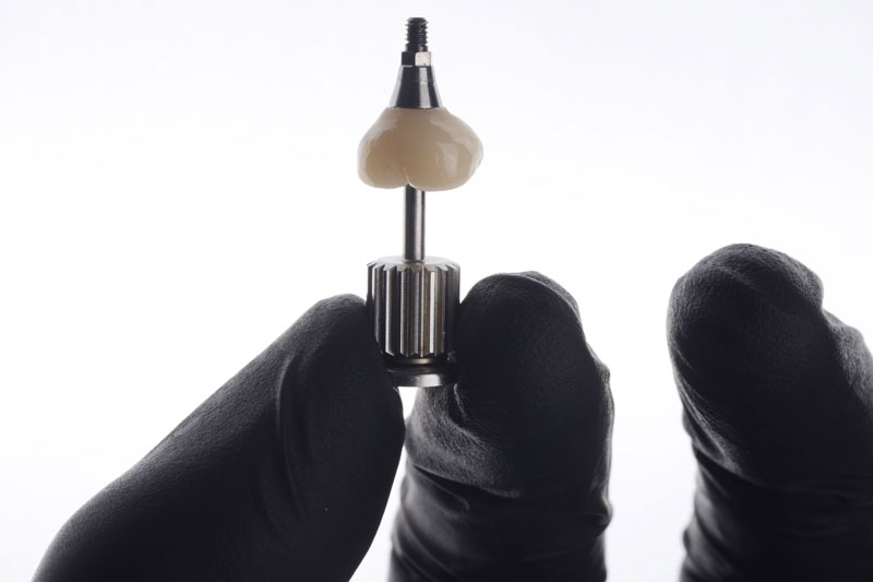 a single dental implant with a screw for placing it into the mouth