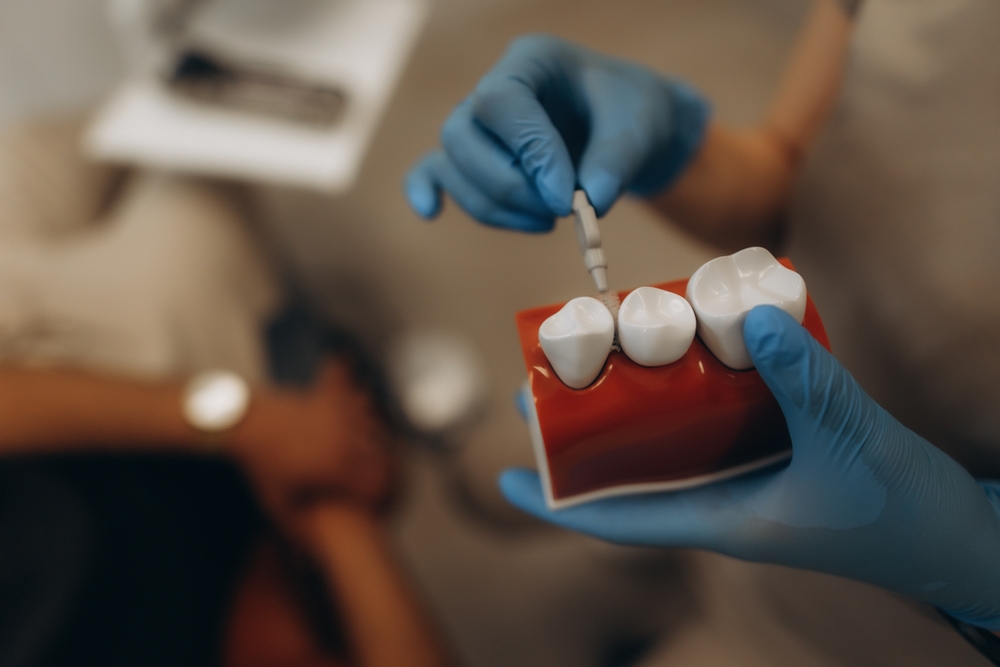 Dental implant consultation in San Antonio with patient and dentist